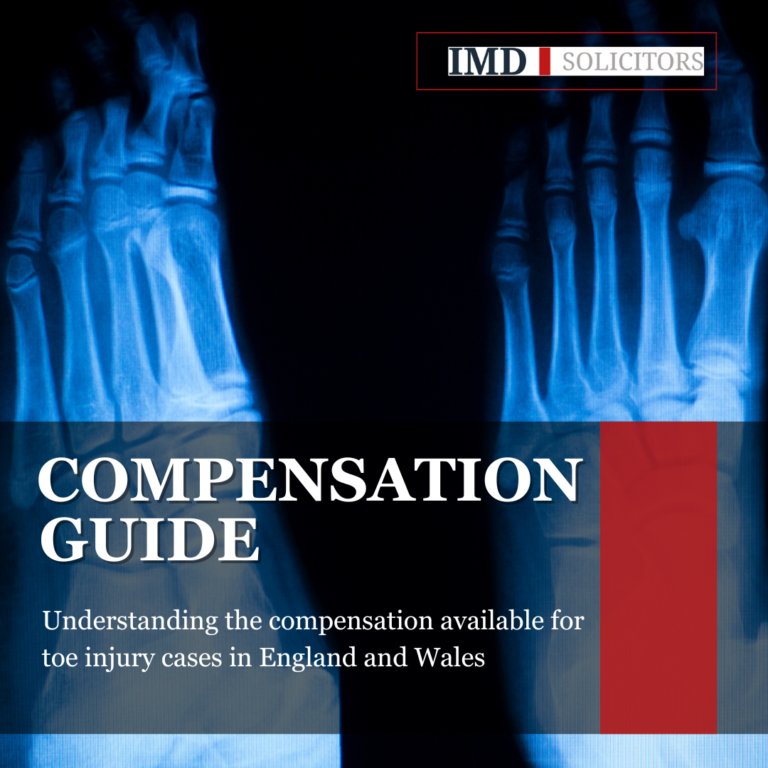 Toe Injury Compensation Explained